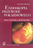 Endoskopia przewodu pokarmowego