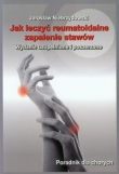 Jak leczyć reumatoidalne zapalenie stawów. Poradnik dla chorych