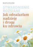 Stwardnienie rozsiane