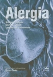 alergia-1.jpg