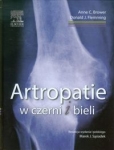 artropatie-w-czerni-i-bieli.jpg
