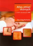 atlas-zmian-skornych-u-osob-zakazonych-hiv.jpg