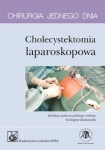 chirurgia-jednego-dnia-cholecystektomia-laparoskopowa.jpg