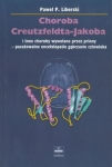choroba-creutzfeldta-jakoba.jpg