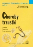 choroby-trzustki-3.jpg