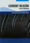 choroby-wlosow-i-skory-owlosionej.jpg