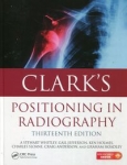 clarks-positioning-in-radiography.jpg