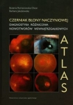 czerniak-blony-naczyniowej-diagnostyka-roznicowa-nowotworow-wewnatrzgalkowych.jpg