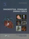 diagnostyka-powiklan-zawalu-serca.jpg
