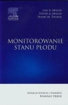 monitorowanie-stanu-plodu.jpg