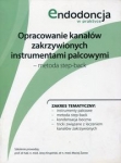 opracowanie-kanalow-zakrzywionych-instrumentami-palcowymi.jpg