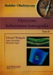 optyczna-koherentna-tomografia-tom-2.jpg
