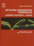 optyczna-koherentna-tomografia.jpg