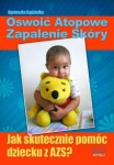 oswoic-atopowe-zapalenie-skory.jpg