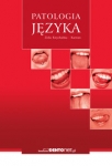 patologia-jezyka.jpg