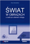 swiat-w-obrazach-u-osob-po-udarach-mozgu.jpg