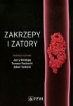 zakrzepy-i-zatory.jpg