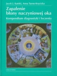 zapalenie-blony-naczyniowej-oka.jpg