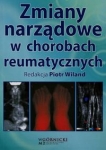 zmiany-narzadowe-w-chorobach-reumatycznych.jpg